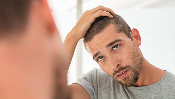 6 Tips on How to Reduce Hair Loss in Men