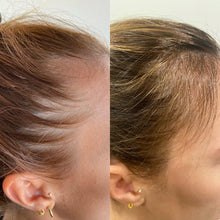 Load image into Gallery viewer, Aéde Hair Activist Hair Skin and Nail Supplement 60 Tablets - 1 Month Supply