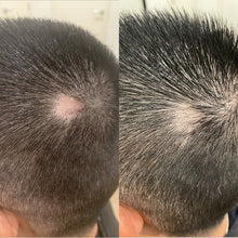 Load image into Gallery viewer, Aéde Power Activist Hair Growth Supplement 60 Tablets - 1 Month Supply