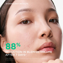 Load image into Gallery viewer, Bioderma Sebium Anti-Blemish Hydrating Serum for Acne-Prone Skin 30ml