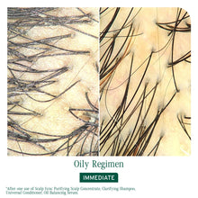 Load image into Gallery viewer, Biolage Scalp Sync Clarifying Shampoo 400ml