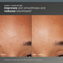 Load image into Gallery viewer, Dermalogica Daily Microfoliant Travel Size 13g