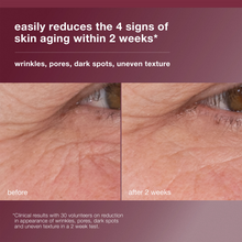 Load image into Gallery viewer, Dermalogica Dynamic Skin Retinol Serum 30ml