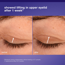 Load image into Gallery viewer, Dermalogica Phyto Nature Lifting Eye Cream 15ml