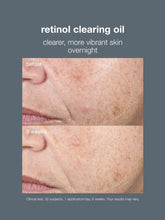 Load image into Gallery viewer, Dermalogica Retinol Clearing Oil 30ml