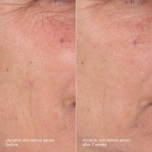 Load image into Gallery viewer, Dermalogica Skin Aging Solutions Kit