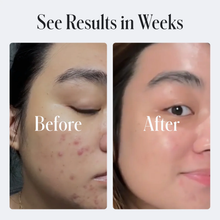 Load image into Gallery viewer, Geologie Acne Control Body Wash 250ml