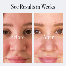 Load image into Gallery viewer, Geologie Acne Control Face Wash 180ml