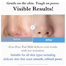 Load image into Gallery viewer, Medicube Zero Pore Pad Mild 70 Pads