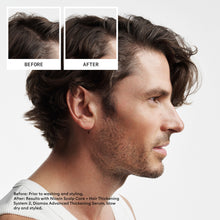 Load image into Gallery viewer, Nioxin Scalp + Hair Thickening System 2 Trio Pack