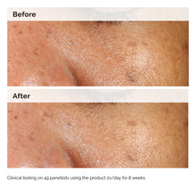 Load image into Gallery viewer, The Ordinary Alpha Arbutin 2% + HA 60ml