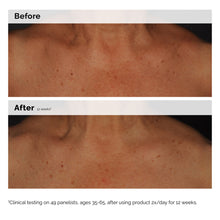 Load image into Gallery viewer, The Ordinary Niacinamide 5% Face and Body Emulsion 100ml