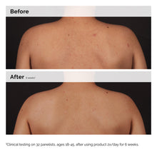 Load image into Gallery viewer, The Ordinary Salicylic Acid 0.5% Body Serum 240ml