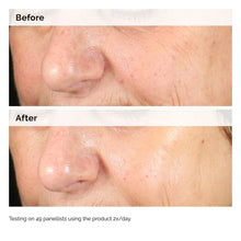 Load image into Gallery viewer, The Ordinary Alpha Arbutin 2% + HA 30ml