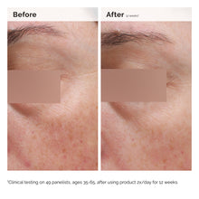 Load image into Gallery viewer, The Ordinary Niacinamide 5% Face and Body Emulsion 100ml