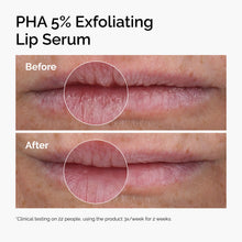 Load image into Gallery viewer, The Ordinary PHA 5% Exfoliating Lip Serum 15ml