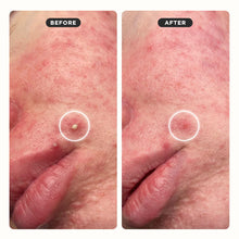 Load image into Gallery viewer, Zitsticka Undercover Ultra Sheer Blemish Patches 36pk