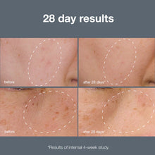 Load image into Gallery viewer, Dermalogica Powerbright Dark Spot System Pack