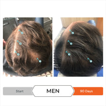 Load image into Gallery viewer, Hair Loss Deluxe Bundle