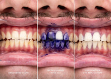 Load image into Gallery viewer, hismile V34 Colour Corrector Serum 30ml